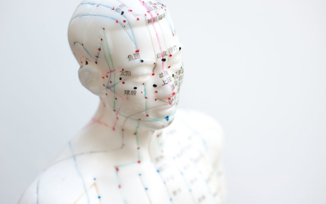 Community Acupuncture